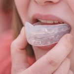 En person som sätter in en genomskinlig tandskena eller ett tandskydd i munnen.