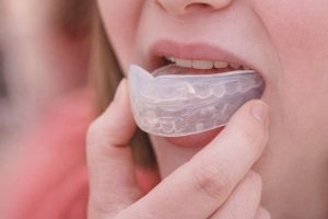 En person som sätter in en genomskinlig tandskena eller ett tandskydd i munnen.