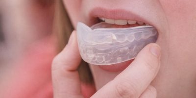 En person som sätter in en genomskinlig tandskena eller ett tandskydd i munnen.